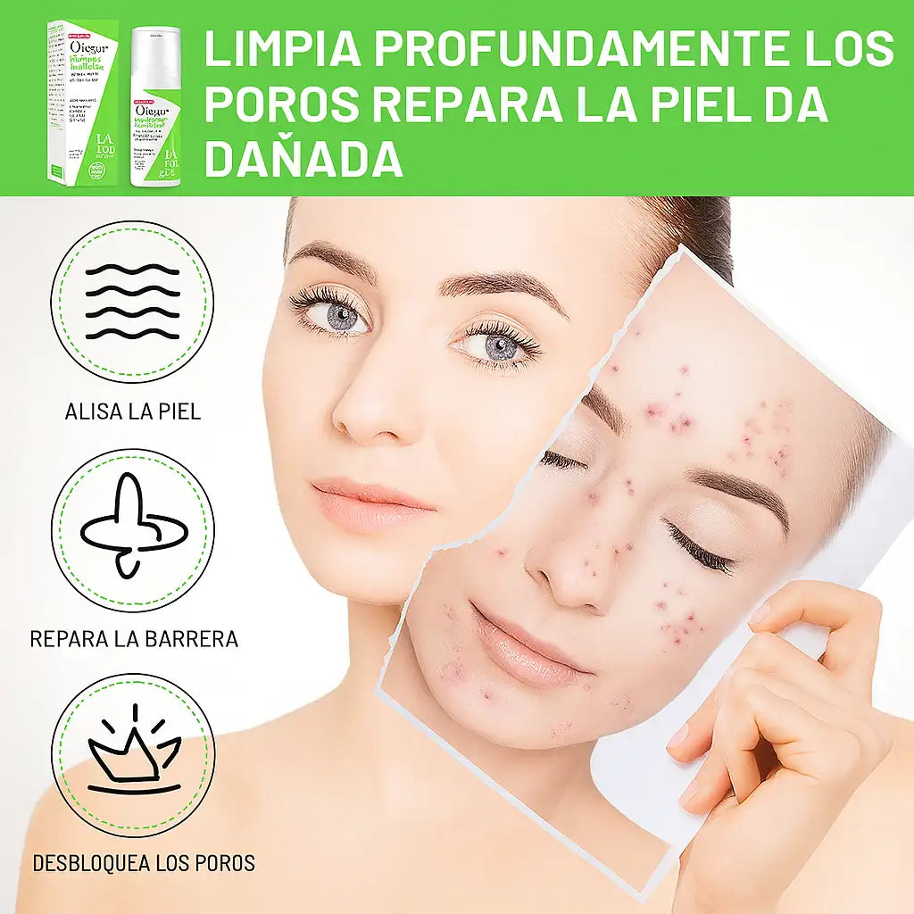 DISAAR SERUM ANTIACNÉ