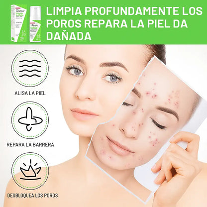DISAAR SERUM ANTIACNÉ